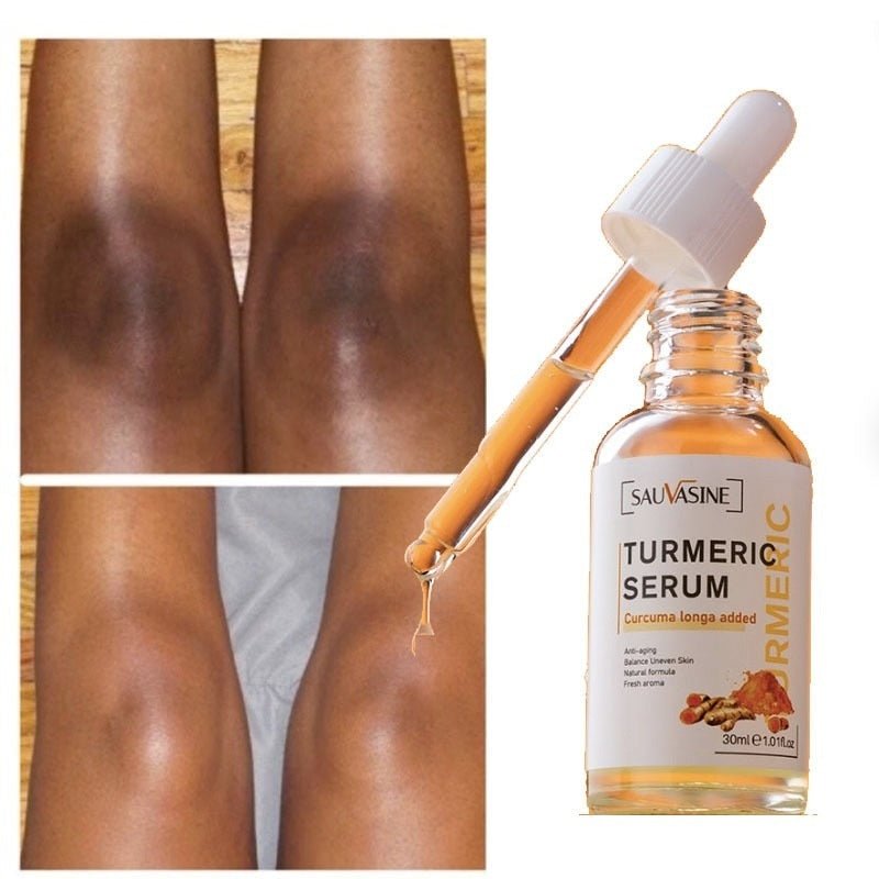 🔥ADIOS MANCHAS OSCURAS ⭐⭐⭐⭐⭐ NUEVO SUERO CORRECTOR DE MANCHAS OSCURAS